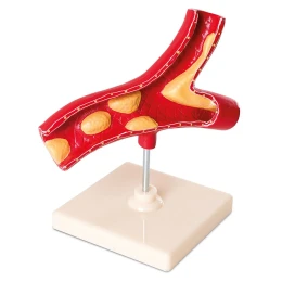 Снимка на Nowa Szkola Модел на артерия, на стойка